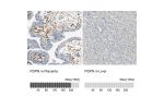 Immunohistochemistry analysis in human placenta and liver tissues using HPA007534 antibody. Corresponding PDPN RNA-seq data are presented for the same tissues.