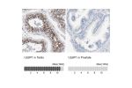 Immunohistochemistry analysis in human testis and prostate tissues using HPA007547 antibody. Corresponding ULBP1 RNA-seq data are presented for the same tissues.