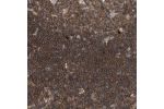 Immunohistochemical staining of human lymph node shows strong cytoplasmic positivity in non-germinal center cells.