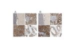Immunohistochemical staining of human cerebellum, kidney, liver and testis using Anti-ACAT1 antibody HPA007569 (A) shows similar protein distribution across tissues to independent antibody HPA004428 (B).