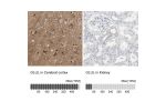 Immunohistochemistry analysis in human cerebral cortex and kidney tissues using HPA007571 antibody. Corresponding GLUL RNA-seq data are presented for the same tissues.