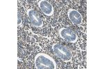Immunohistochemical staining of human endometrium shows weak to moderate cytoplasmic positivity in stromal cells.