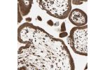 Immunohistochemical staining of human placenta shows strong granular cytoplasmic positivity in trophoblastic cells.