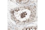 Immunohistochemical staining of human testis shows strong cytoplasmic positivity in cells in seminiferous ducts.