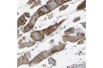 Immunohistochemical staining of human skeletal muscle shows strong cytoplasmic positivity in myocytes.