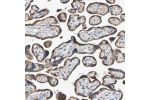 Immunohistochemical staining of human placenta shows strong membranous and cytoplasmic positivity in trophoblastic cells.