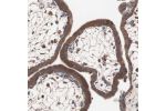 Immunohistochemical staining of human placenta shows moderate cytoplasmic positivity in trophoblastic cells.
