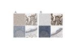Immunohistochemical staining of human cerebral cortex, gastrointestinal, lymph node and skin using Anti-MST1R antibody HPA007657 (A) shows similar protein distribution across tissues to independent antibody HPA008180 (B).