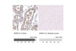 Immunohistochemical staining of human spleen shows strong cytoplasmic positivity in cells in red pulp and white pulp).