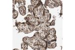 Immunohistochemical staining of human placenta shows strong cytoplasmic and membranous positivity in trophoblastic cells.
