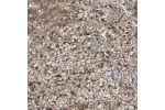 Immunohistochemical staining of human adrenal gland shows strong cytoplasmic positivity in glandular cells.