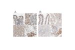 Immunohistochemical staining of human colon, kidney, liver and testis using Anti-PROS1 antibody HPA007724 (A) shows similar protein distribution across tissues to independent antibody HPA023974 (B).