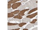 Immunohistochemical staining of human skeletal muscle shows strong cytoplasmic positivity in subsets of muscle fibers.