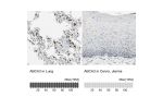 Immunohistochemistry analysis in human lung and cervix, uterine tissues using HPA007884 antibody. Corresponding ABCA3 RNA-seq data are presented for the same tissues.