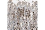 Immunohistochemical staining of human rectum shows strong cytoplasmic positivity in lymphoid cells.