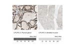 Immunohistochemistry analysis in human thyroid gland and skeletal muscle tissues using HPA007891 antibody. Corresponding LPCAT2 RNA-seq data are presented for the same tissues.