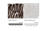Immunohistochemistry analysis in human stomach and skeletal muscle tissues using HPA007912 antibody. Corresponding AGR2 RNA-seq data are presented for the same tissues.