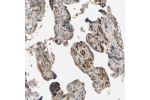 Immunohistochemical staining of human placenta shows weak to moderate cytoplasmic positivity in trophoblastic cells.