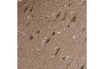 Immunohistochemical staining of human cerebral cortex shows strong cytoplasmic positivity in neuronal cells and glial cells.