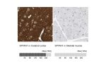 Immunohistochemistry analysis in human cerebral cortex and skeletal muscle tissues using HPA007927 antibody. Corresponding SPTAN1 RNA-seq data are presented for the same tissues.