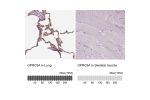 Immunohistochemistry analysis in human lung and skeletal muscle tissues using HPA007928 antibody. Corresponding GPRC5A RNA-seq data are presented for the same tissues.