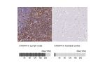 Immunohistochemistry analysis in human lymph node and cerebral cortex tissues using HPA007973 antibody. Corresponding S100A4 RNA-seq data are presented for the same tissues.