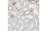 Immunohistochemical staining of human kidney shows moderate positivity in a subset of tubules.