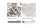 Immunohistochemistry analysis in human placenta and skeletal muscle tissues using HPA008001 antibody. Corresponding LRPAP1 RNA-seq data are presented for the same tissues.