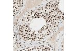 Immunohistochemical staining of human testis shows strong nuclear positivity in cells in seminiferous ducts.