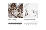 Immunohistochemistry analysis in human prostate and skeletal muscle tissues using HPA008066 antibody. Corresponding CALD1 RNA-seq data are presented for the same tissues.