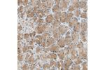 Immunohistochemical staining of human stomach shows moderate cytoplasmic positivity in glandular cells.
