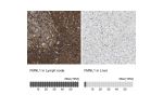 Immunohistochemistry analysis in human lymph node and liver tissues using HPA008129 antibody. Corresponding FMNL1 RNA-seq data are presented for the same tissues.