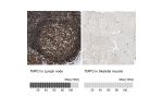 Immunohistochemistry analysis in human lymph node and skeletal muscle tissues using HPA008150 antibody. Corresponding TMPO RNA-seq data are presented for the same tissues.