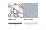 Immunohistochemistry analysis in human lung and pancreas tissues using Anti-CRTAC1 antibody. Corresponding CRTAC1 RNA-seq data are presented for the same tissues.