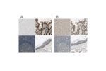 Immunohistochemical staining of human cerebral cortex, gastrointestinal, lymph node and skin using Anti-MST1R antibody HPA008180 (A) shows similar protein distribution across tissues to independent antibody HPA007657 (B).