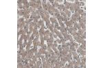 Immunohistochemical staining of human liver shows moderate cytoplasmic positivity in hepatocytes.