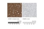 Immunohistochemistry analysis in human cerebral cortex and liver tissues using HPA008209 antibody. Corresponding STXBP1 RNA-seq data are presented for the same tissues.