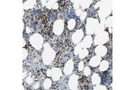 Immunohistochemical staining of human bone marrow shows strong nuclear positivity in subset of hematopoietic cells.