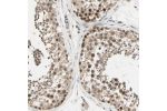 Immunohistochemical staining of human testis shows moderate to strong nuclear positivity in cells in seminiferous ducts.