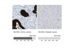 Immunohistochemistry analysis in human cervix, uterine and skeletal muscle tissues using HPA008246 antibody. Corresponding MUC5B RNA-seq data are presented for the same tissues.