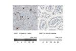 Immunohistochemistry analysis in human cerebral cortex and small intestine tissues using HPA008273 antibody. Corresponding MAP2 RNA-seq data are presented for the same tissues.