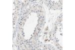 Immunohistochemical staining of human testis shows cytoplasmic positivity in cells in seminiferous ducts and Leydig cells.