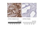 Immunohistochemistry analysis in human skeletal muscle and prostate tissues using Anti-ACTN2 antibody. Corresponding ACTN2 RNA-seq data are presented for the same tissues.