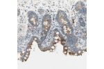 Immunohistochemical staining of human Colon shows moderate granular cytoplasmic positivity in glandular cells.