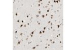Immunohistochemical staining of human cerebral cortex shows strong nuclear positivity in neuronal cells.