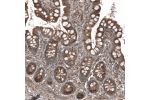 Immunohistochemical staining of human gastrointestinal shows moderate granular cytoplasmic positivity in glandular cells.