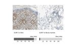 Immunohistochemistry analysis in human skin and bone marrow tissues using HPA008346 antibody. Corresponding SUN1 RNA-seq data are presented for the same tissues.