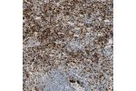 Immunohistochemical staining of human spleen shows moderate cytoplasmic positivity in cells in red pulp.