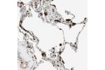 Immunohistochemical staining of human adrenal gland shows strong nuclear and cytoplasmic positivity in cortical cells.
