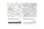 Immunohistochemistry analysis in human adipose tissue and skeletal muscle tissues using HPA008421 antibody. Corresponding PRKAR2B RNA-seq data are presented for the same tissues.